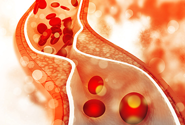 再生医療(自費診療)